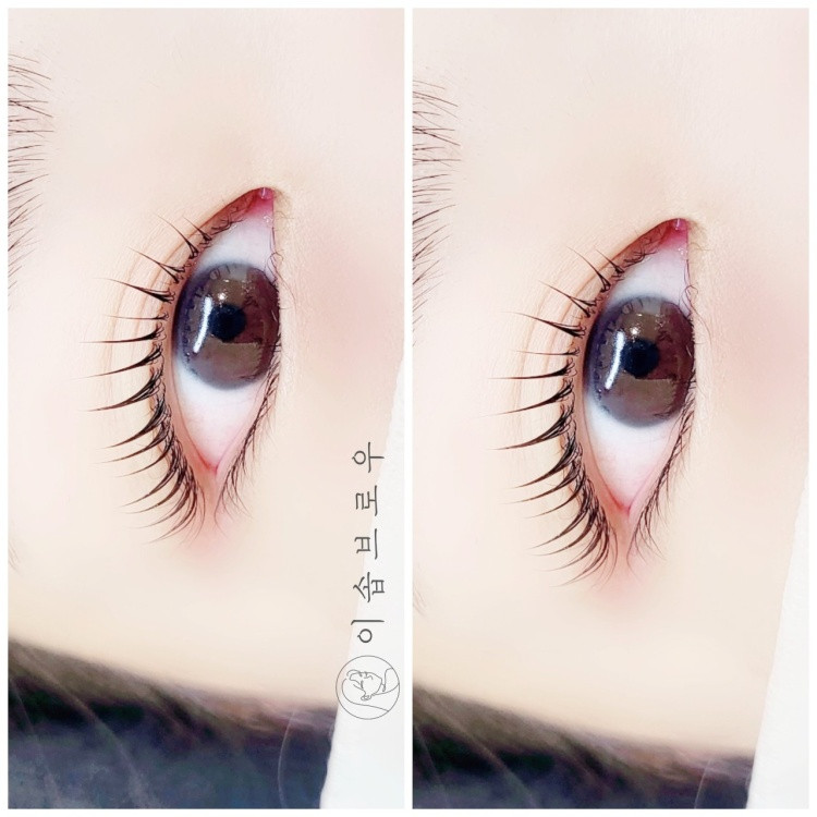 이솝브로우