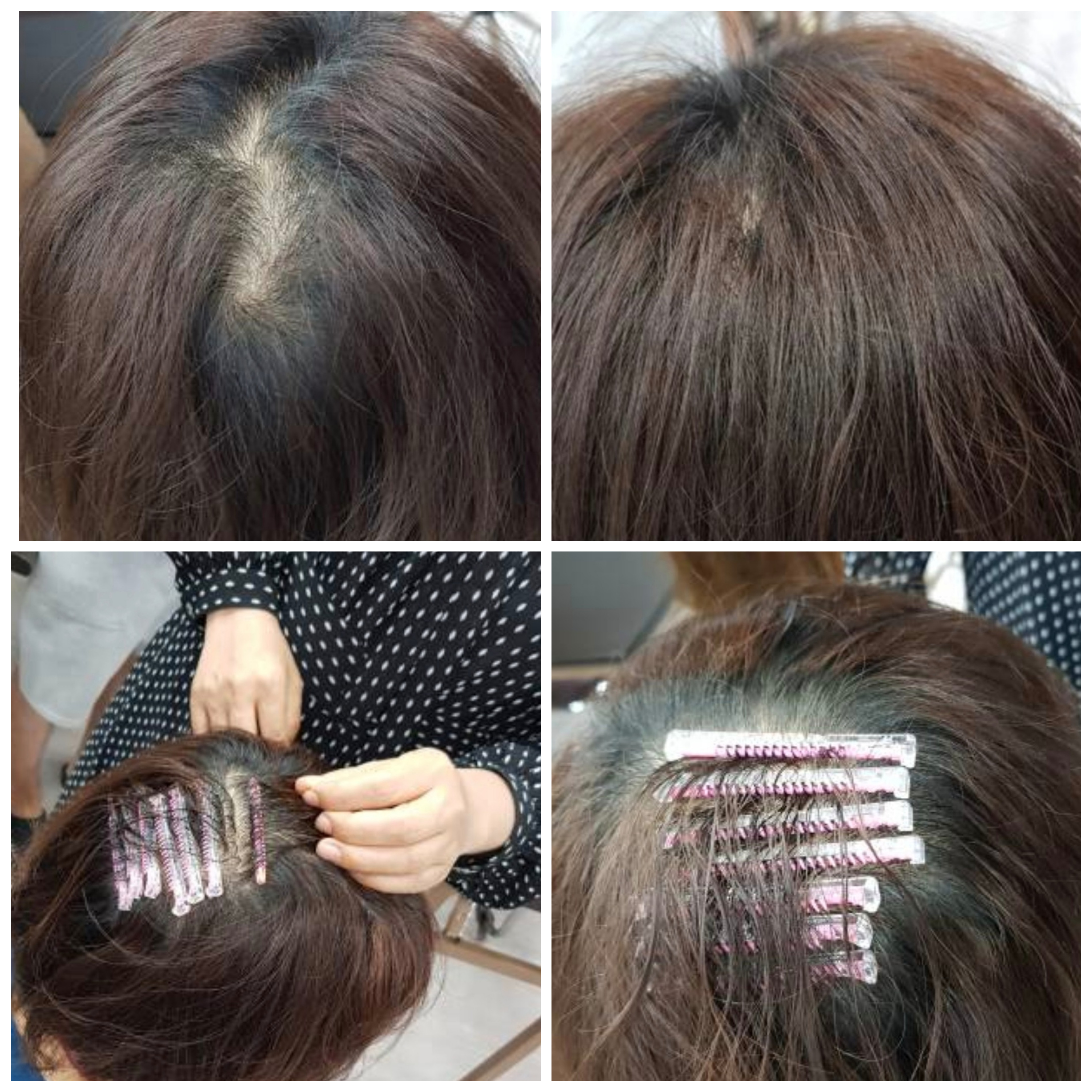 헤어힐링professional