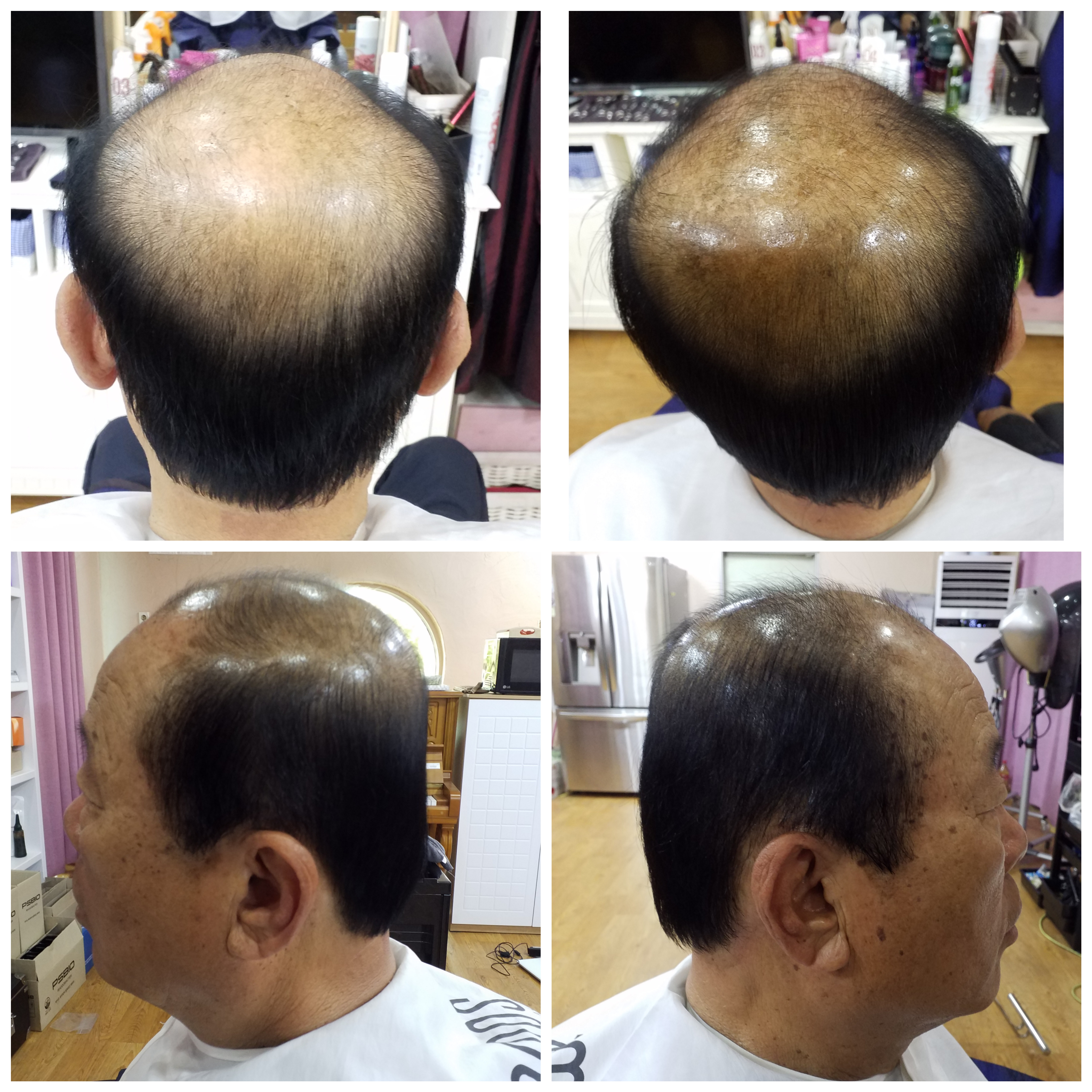 헤어힐링professional