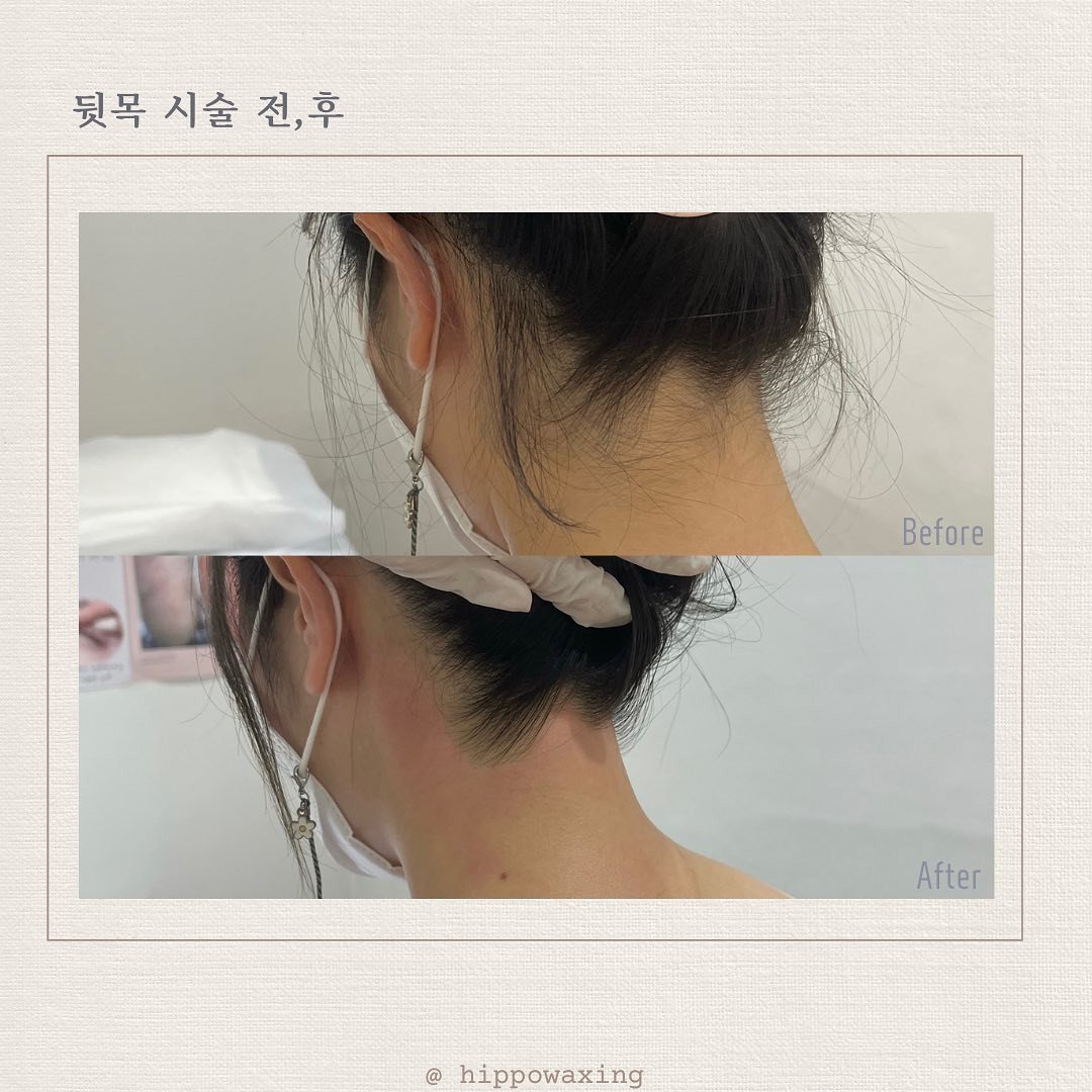 히포왁싱