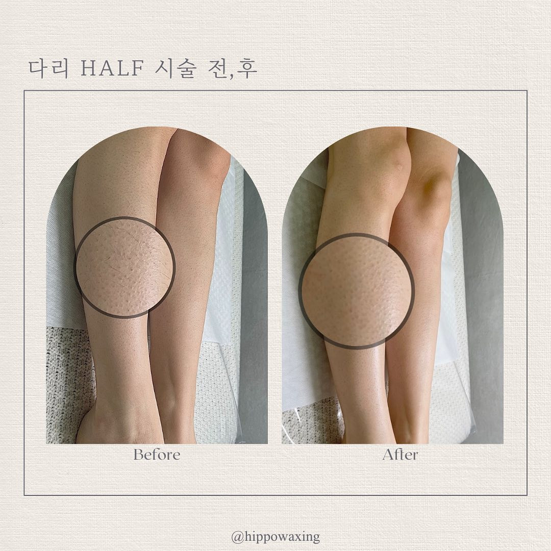 히포왁싱