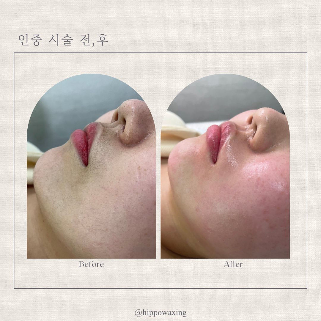 히포왁싱