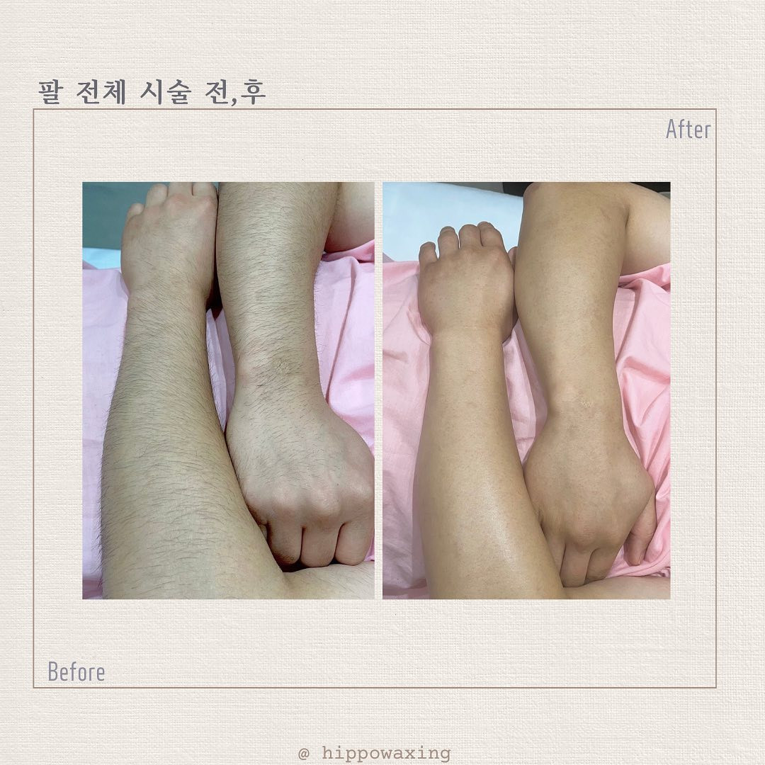 히포왁싱