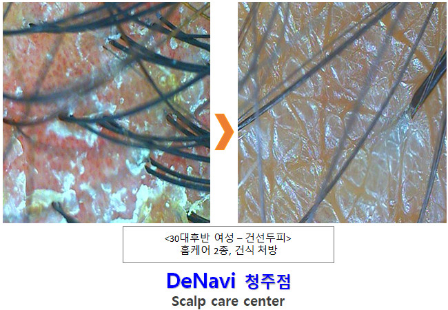 드나비 청주점