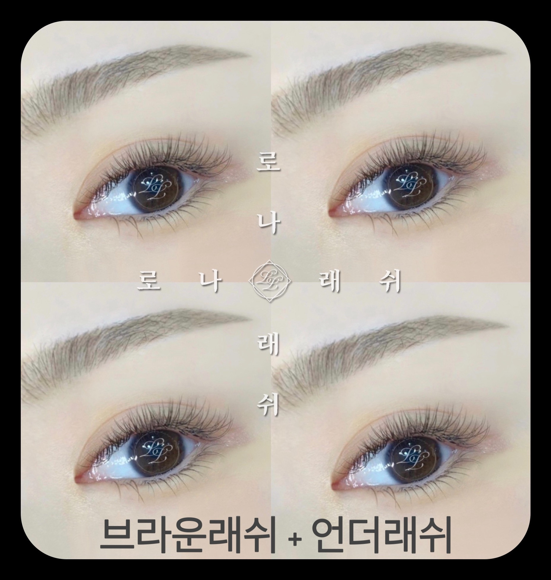 로나래쉬