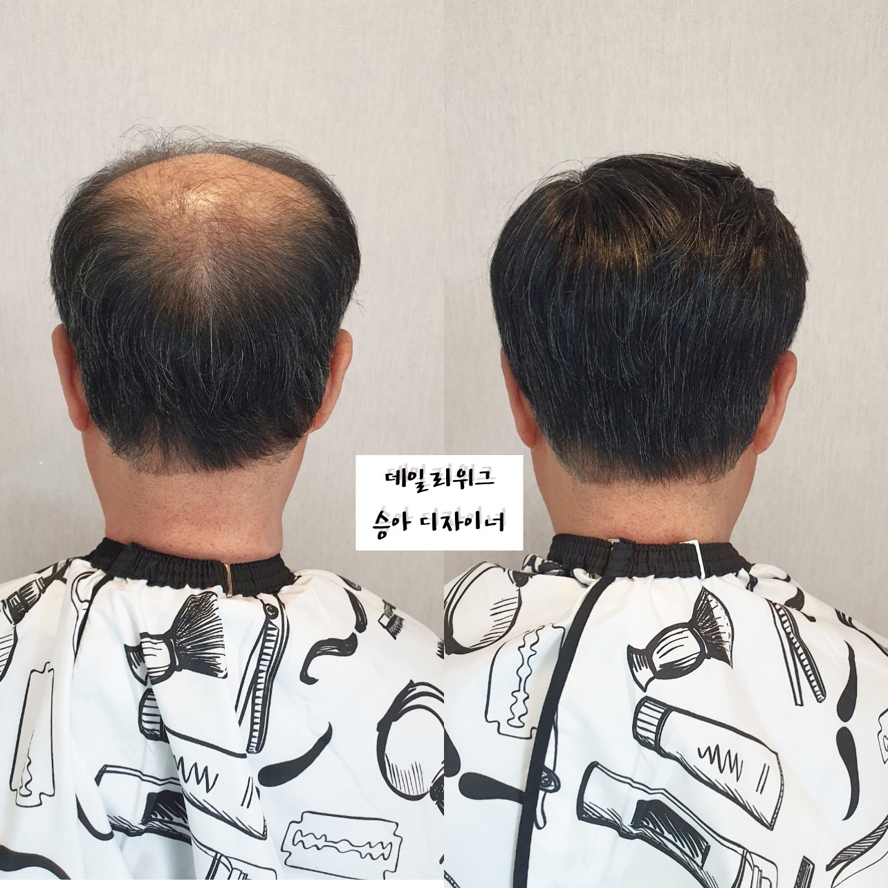 데일리위그가발전문점