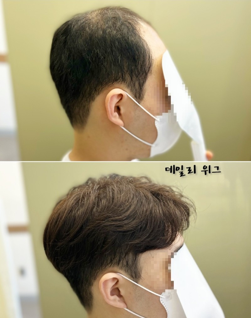 데일리위그가발전문점