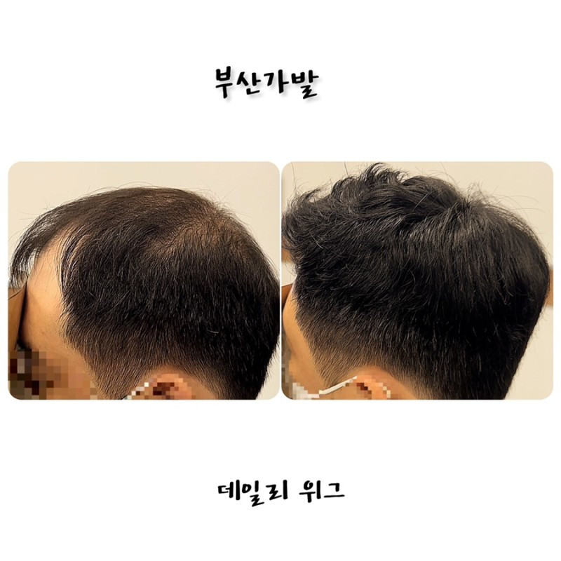 데일리위그가발전문점