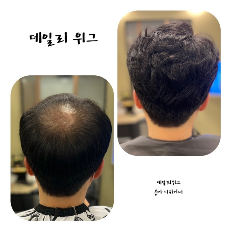 데일리위그가발전문점