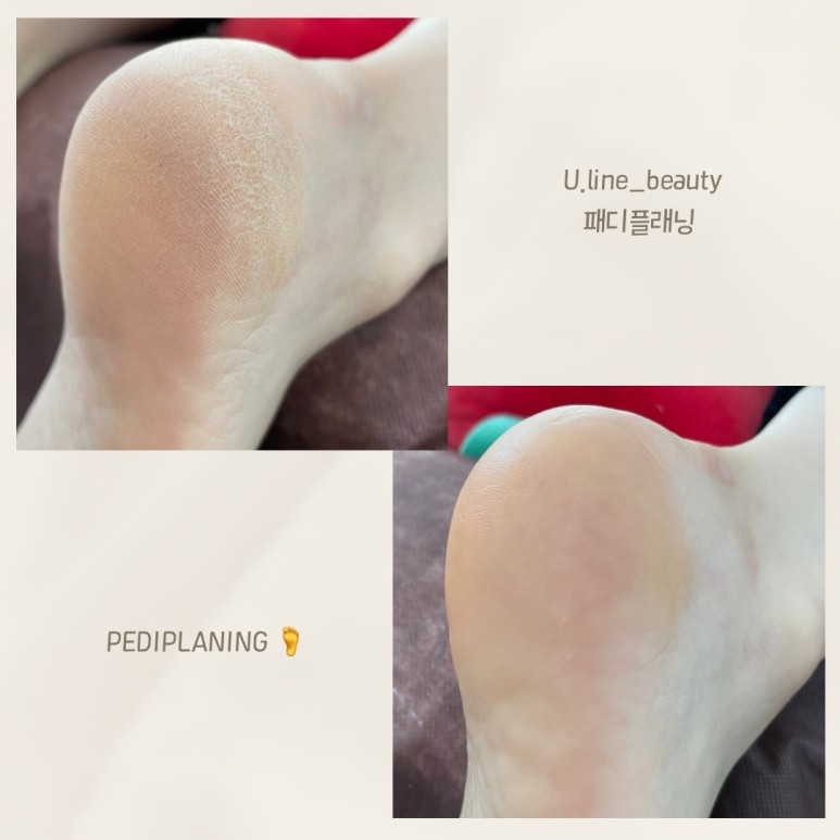 유라인뷰티