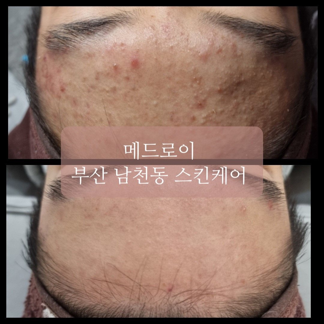 매드로이피부샵
