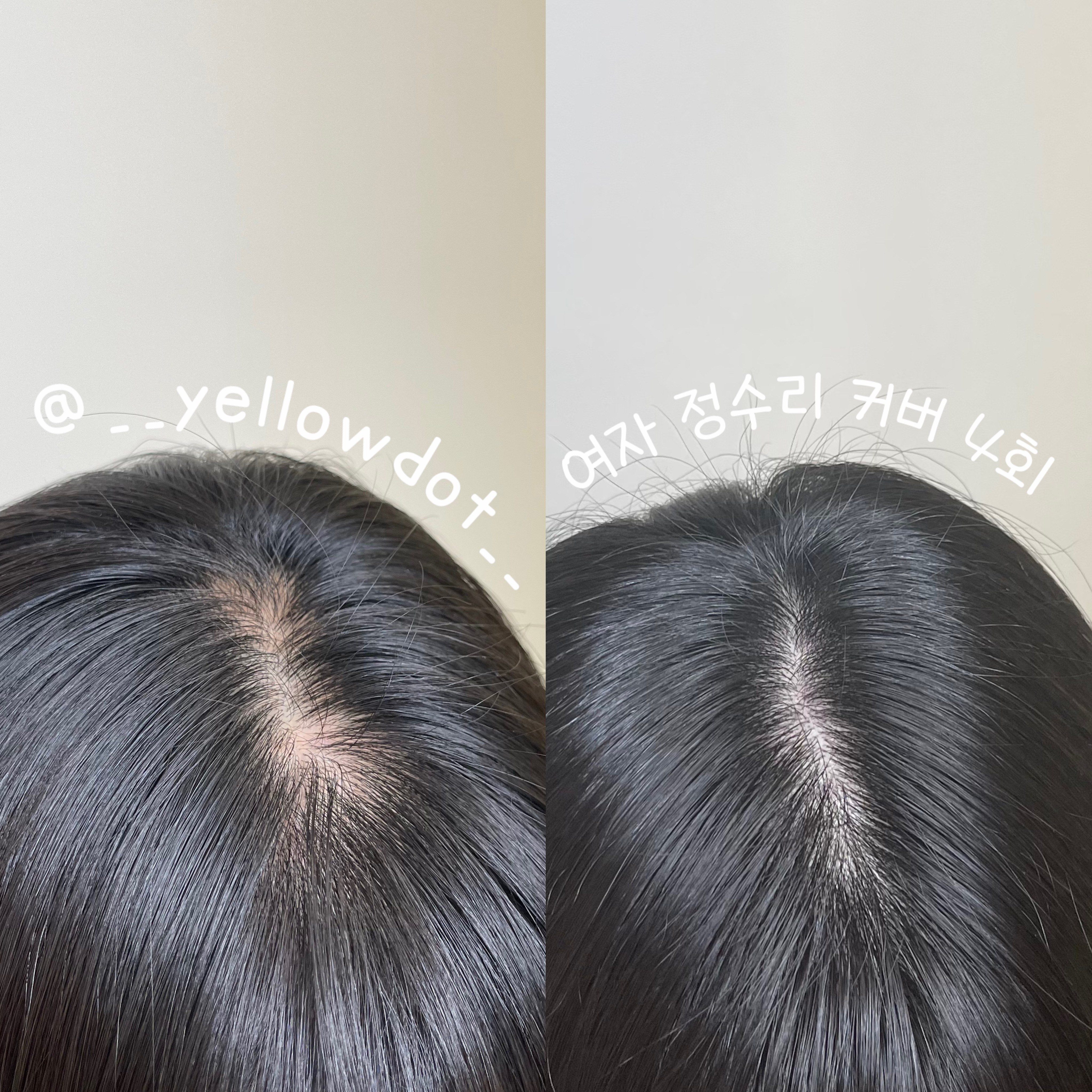 옐로도트