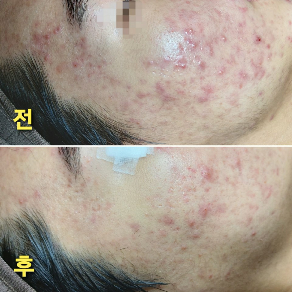 꽃처럼피어날그대