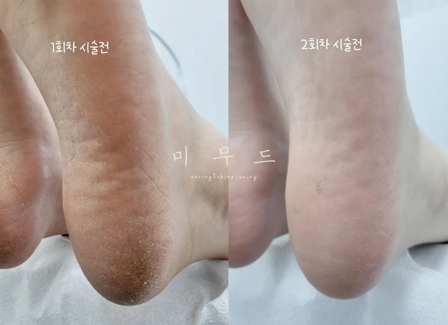 미무드