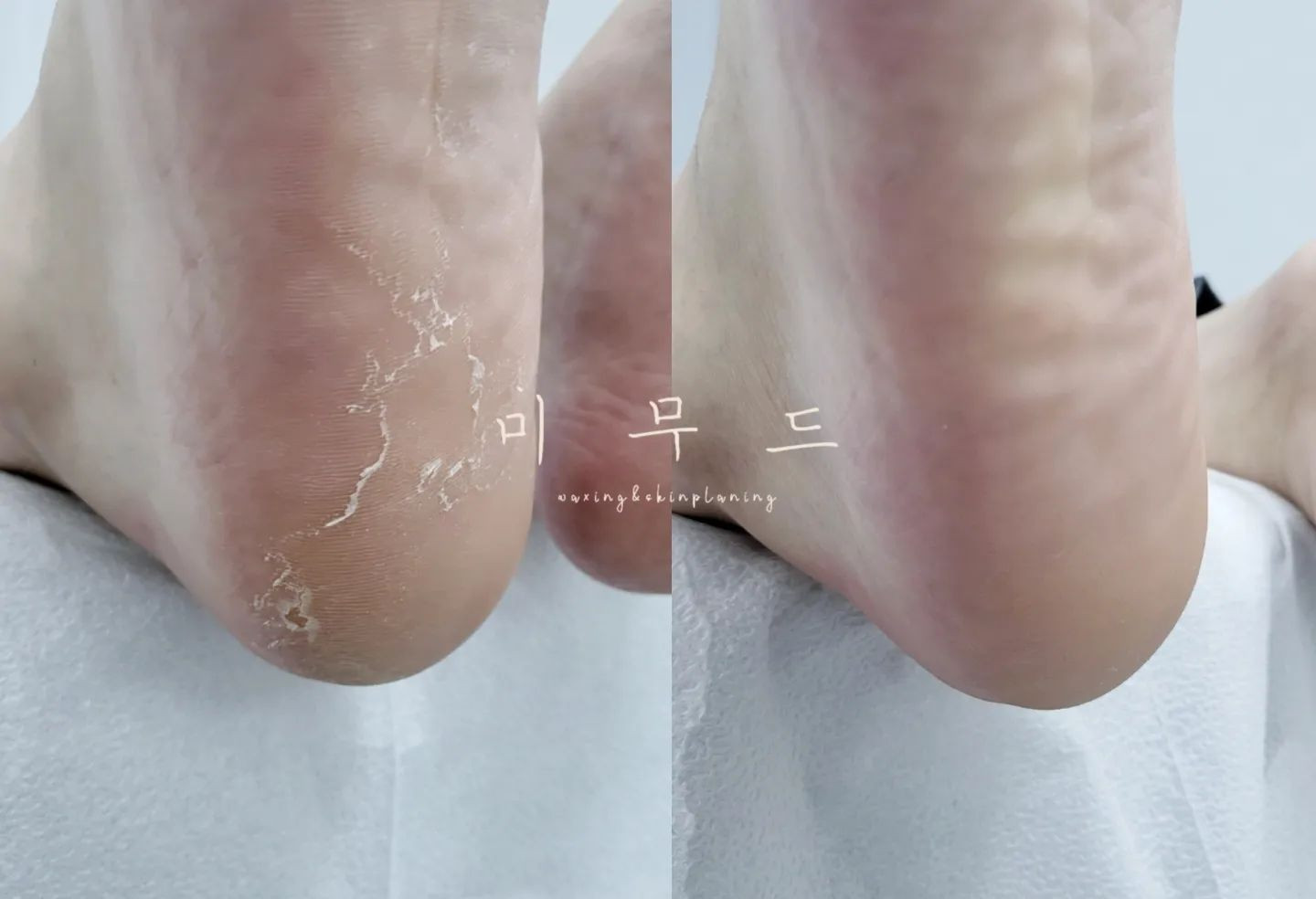 미무드