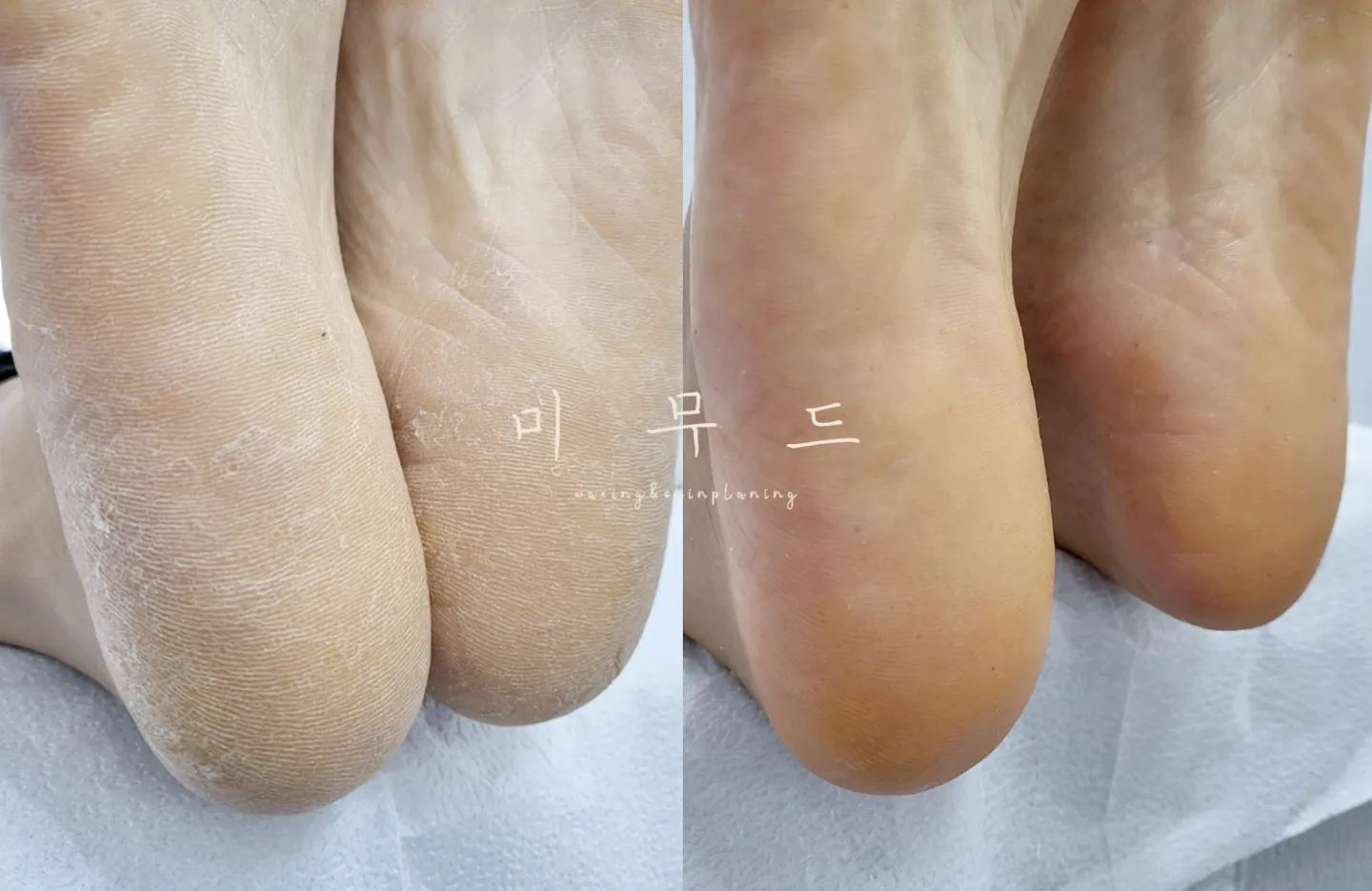 미무드