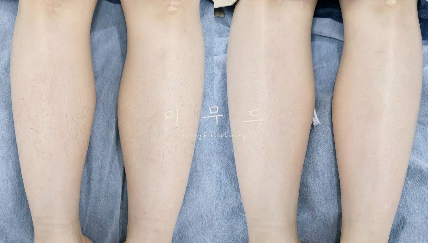 미무드