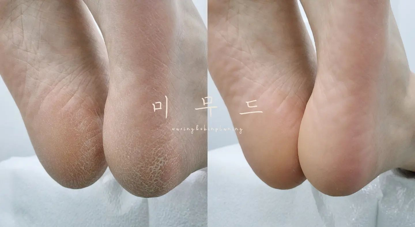 미무드