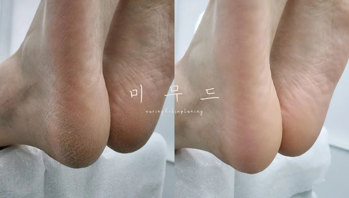 미무드