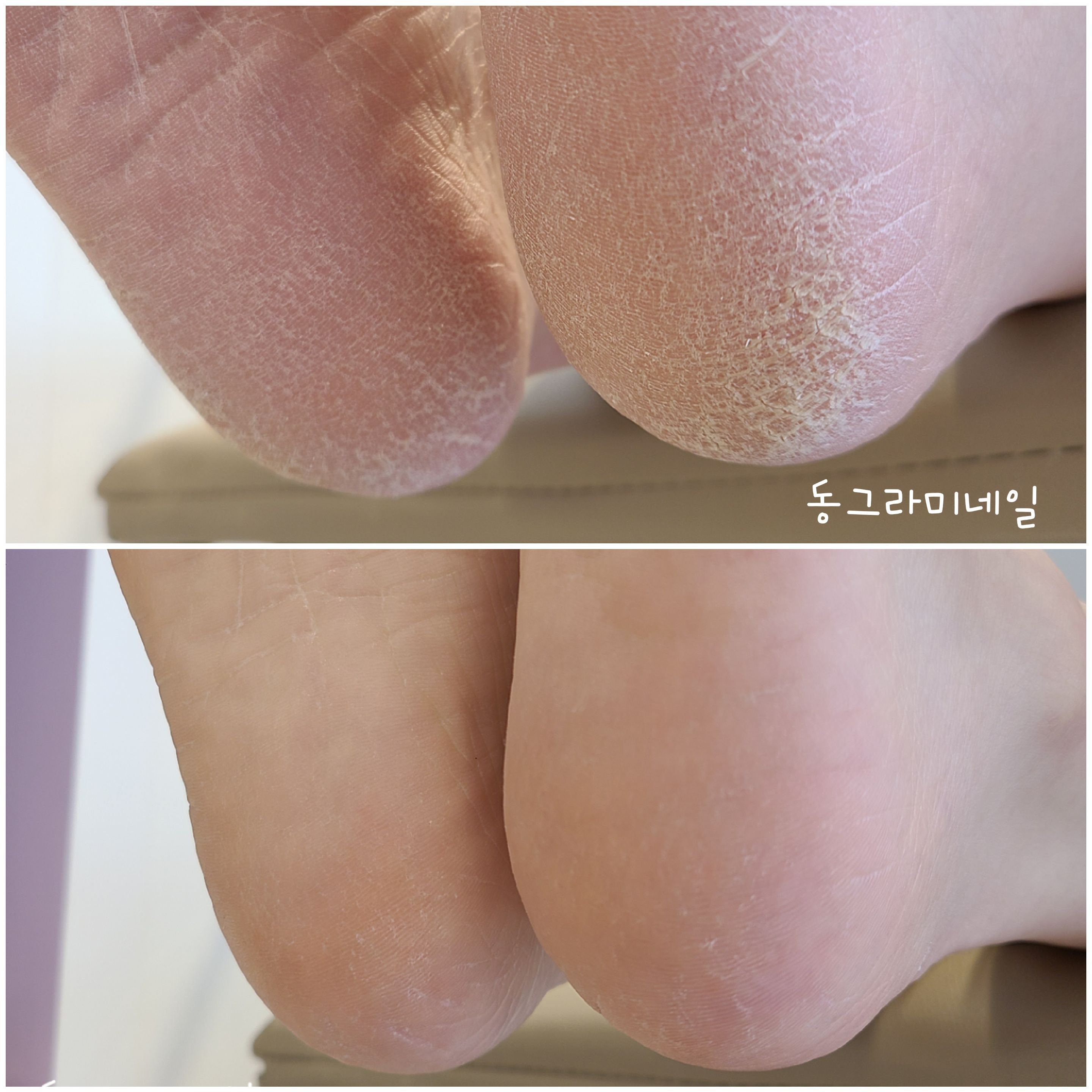 동그라미네일