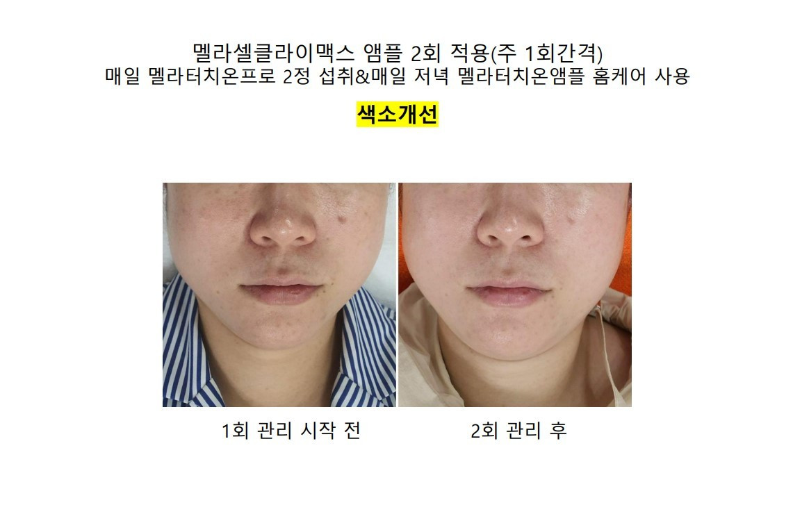 영앤뷰티