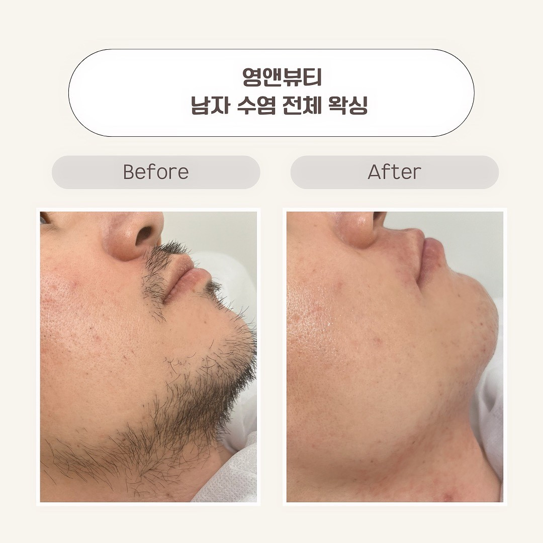 영앤뷰티