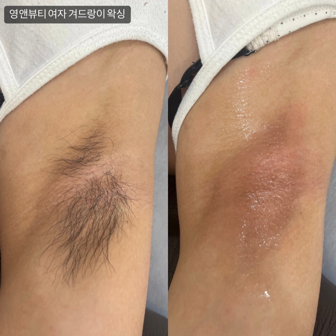 영앤뷰티