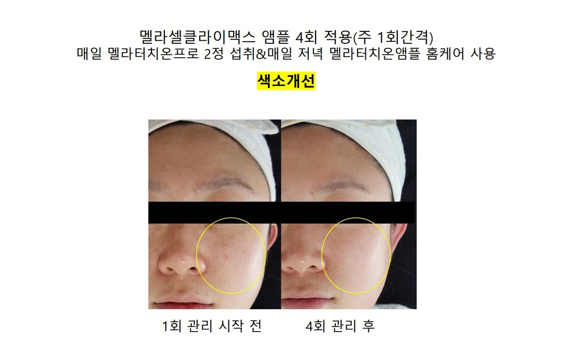 영앤뷰티