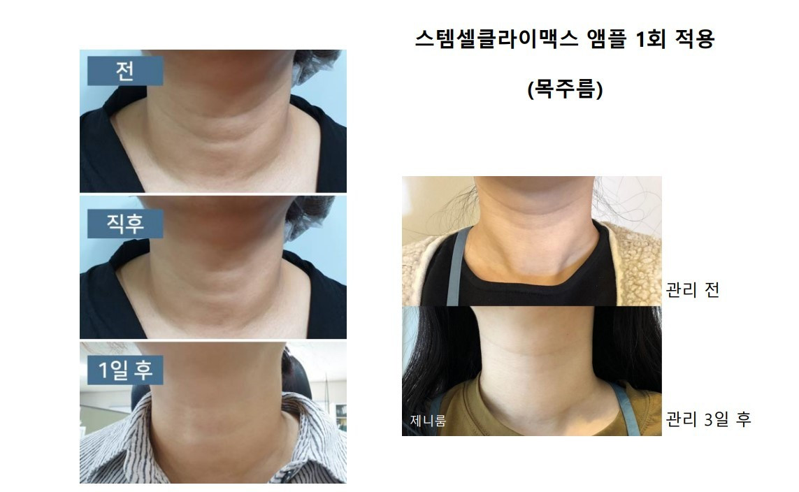 영앤뷰티