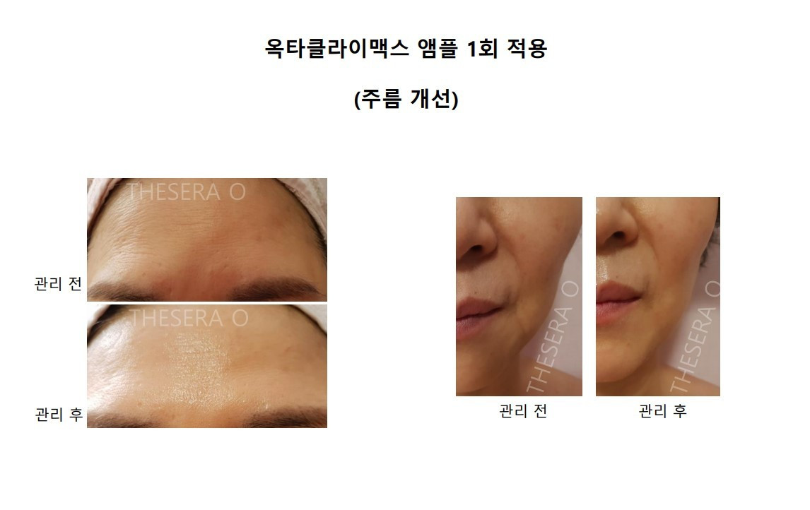 영앤뷰티