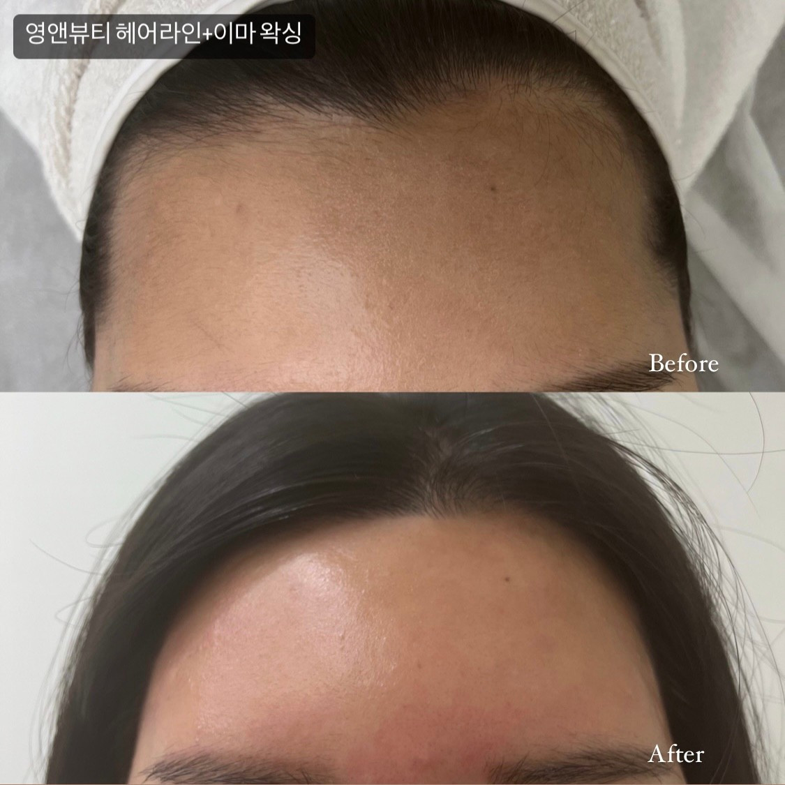 영앤뷰티