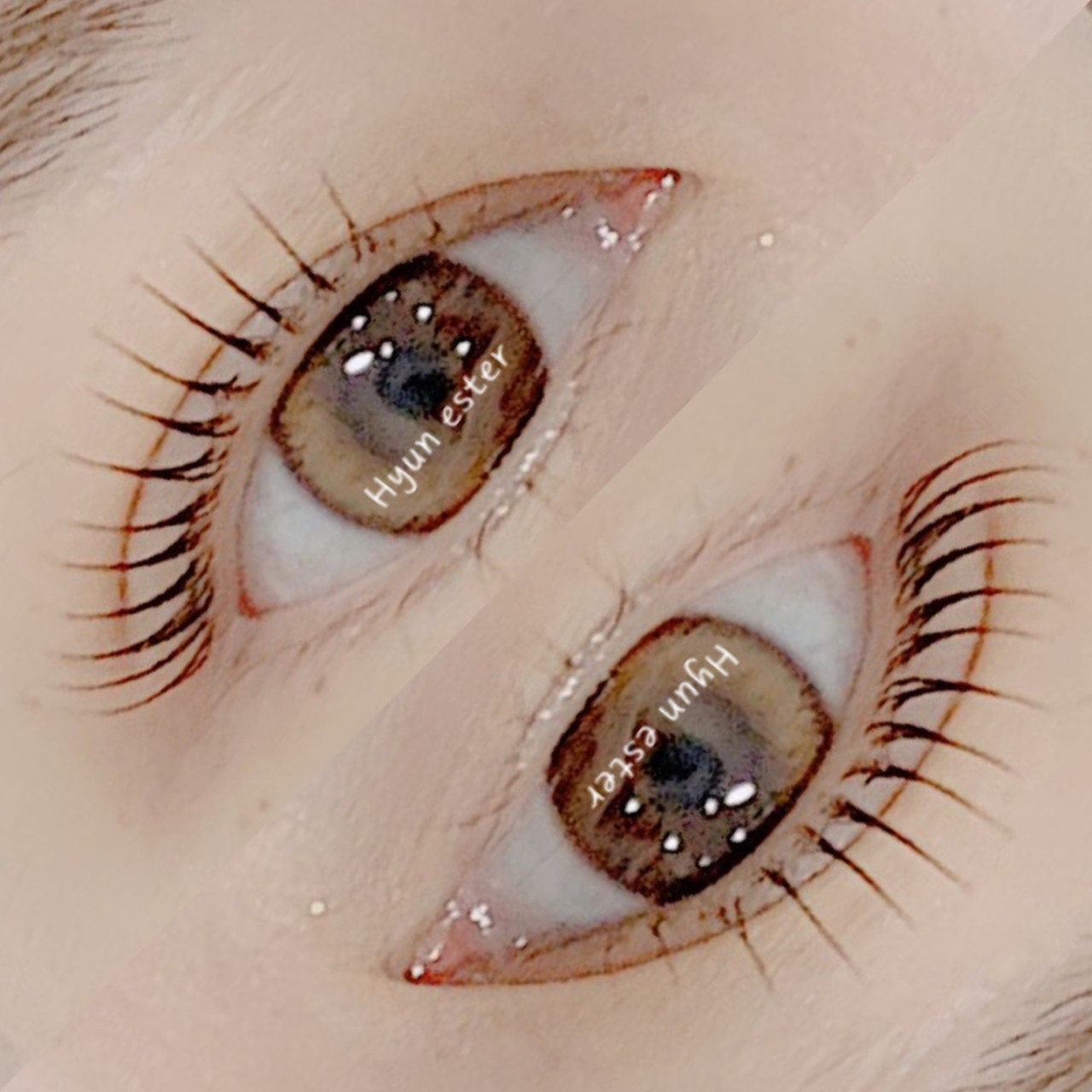 숨앤쉼에스테틱