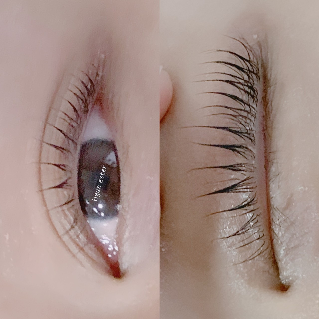 숨앤쉼에스테틱