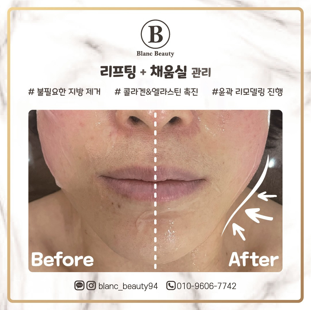 블랑뷰티(BLANCBEAUTY)