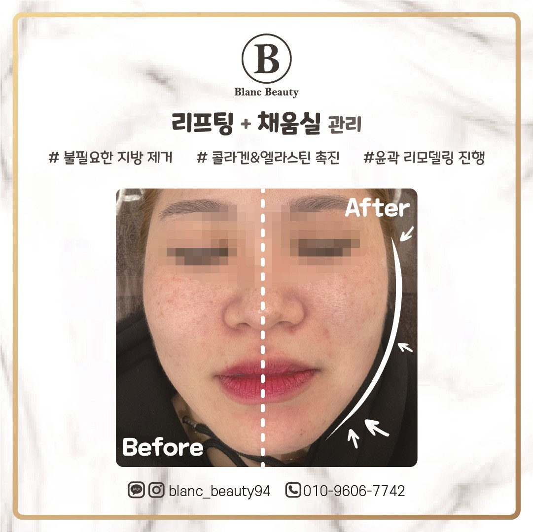 블랑뷰티(BLANCBEAUTY)