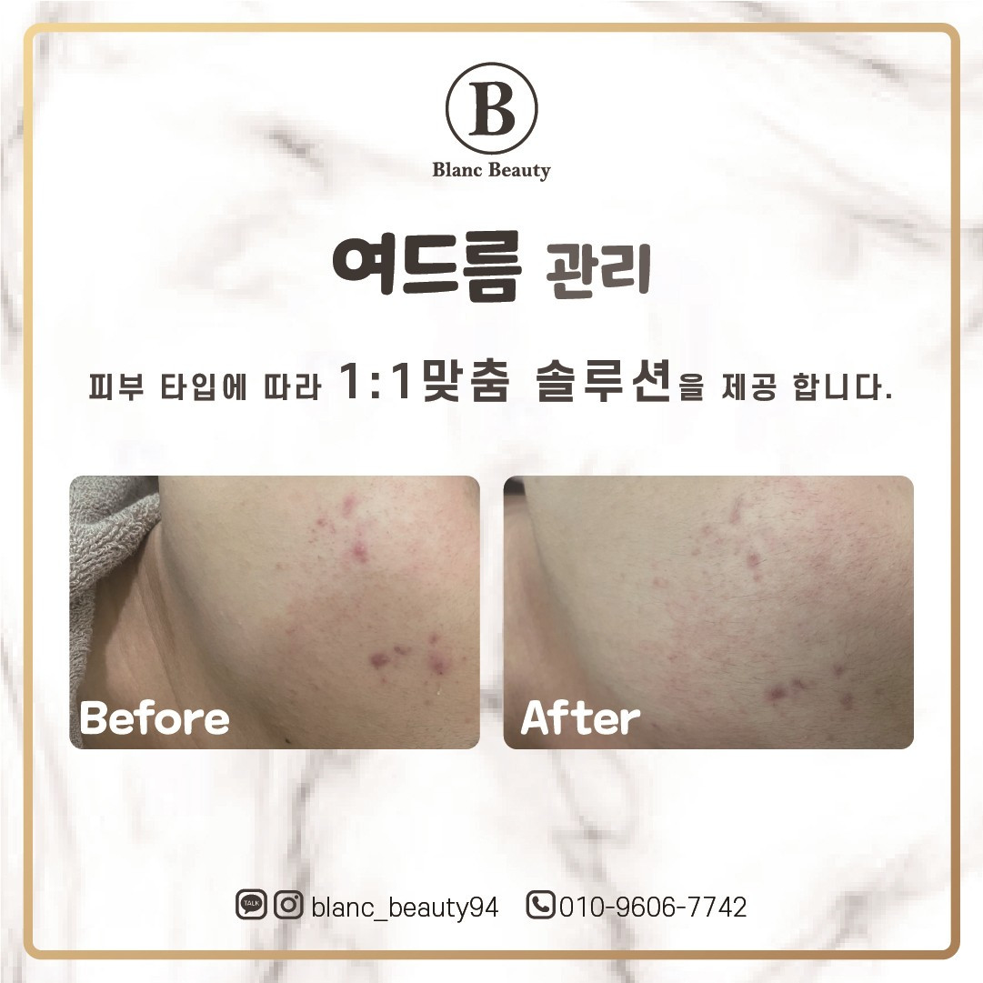 블랑뷰티(BLANCBEAUTY)