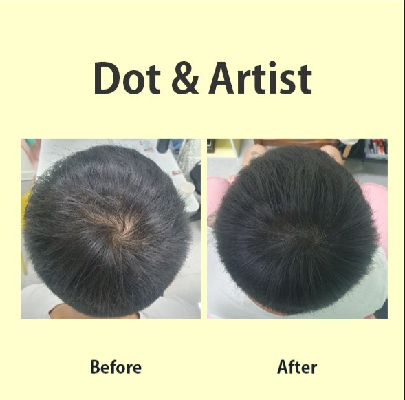 다트앤아티스트