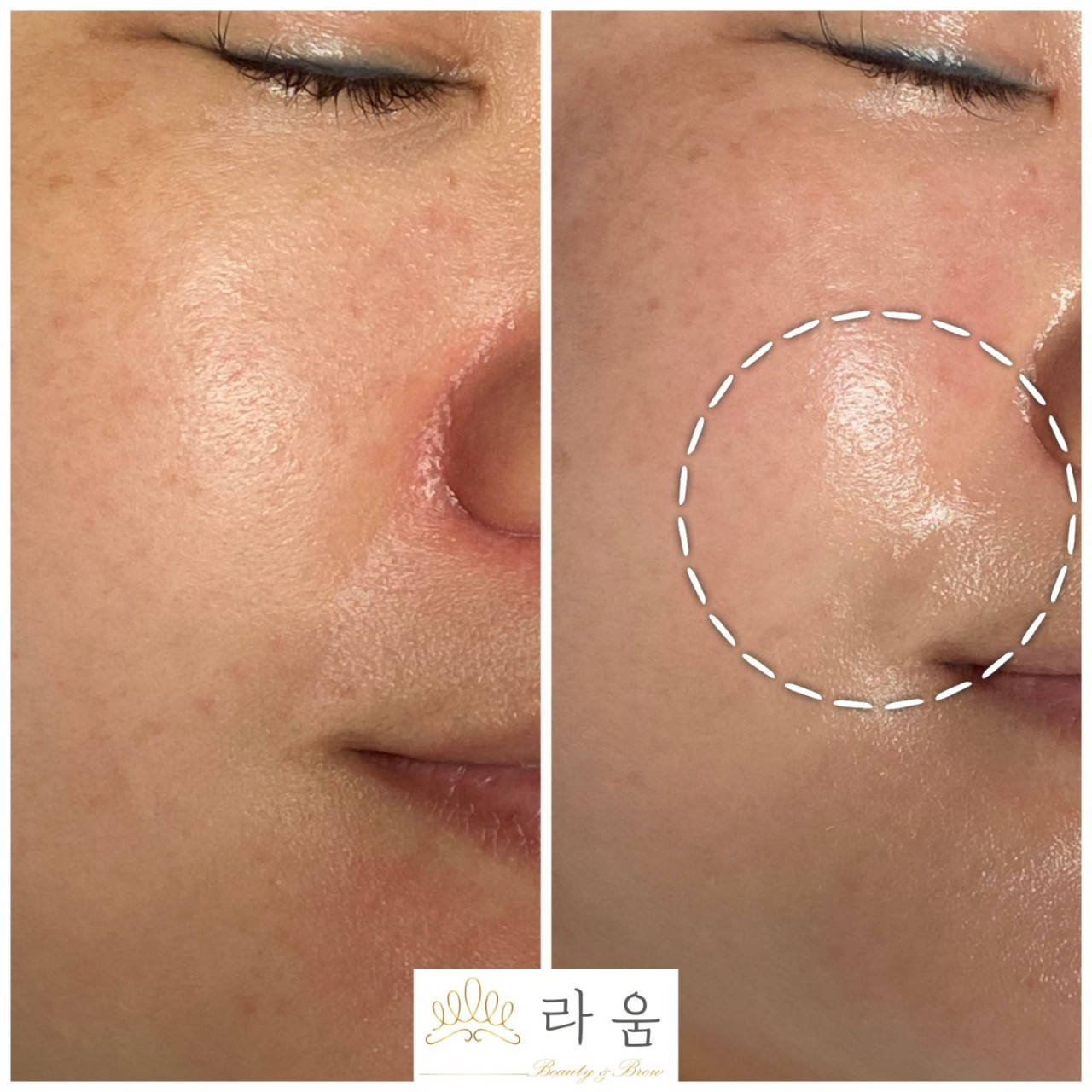 라움뷰티