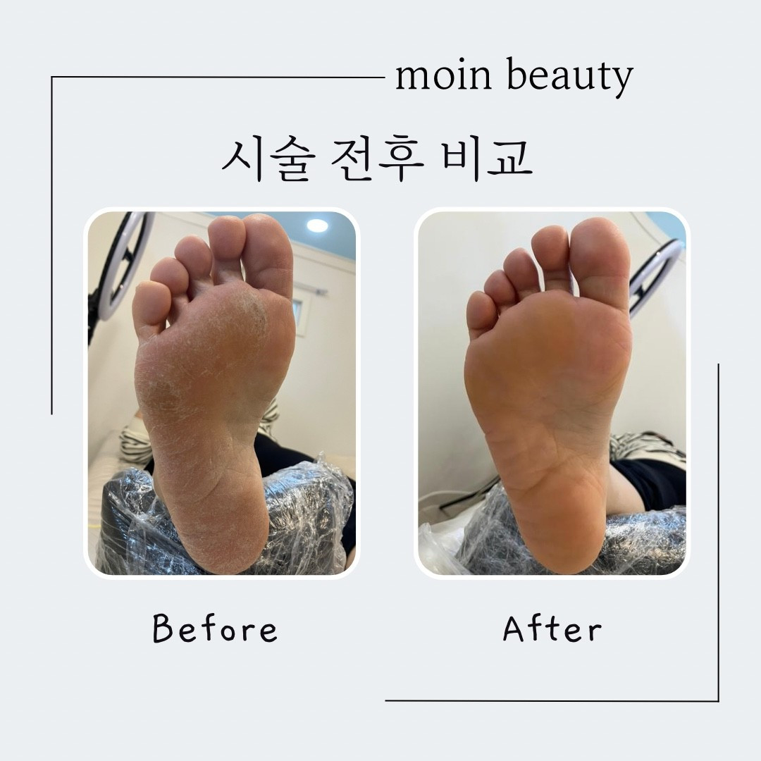 모인뷰티