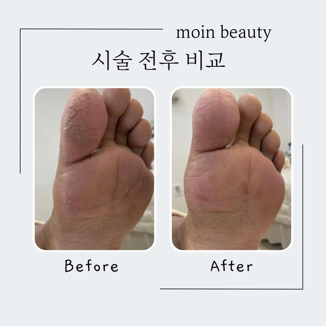 모인뷰티