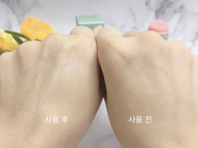 임송연뷰티앤스킨