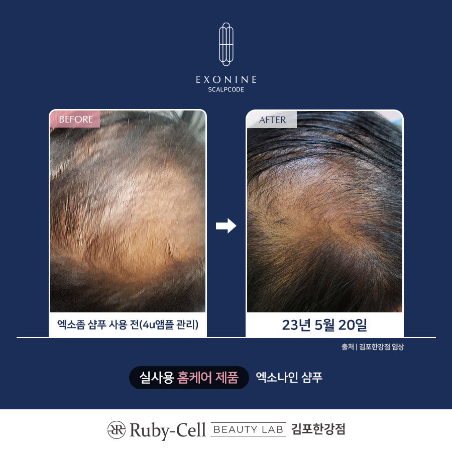 루비셀뷰티랩김포한강점