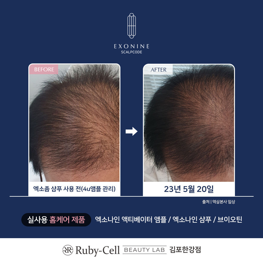 루비셀뷰티랩김포한강점