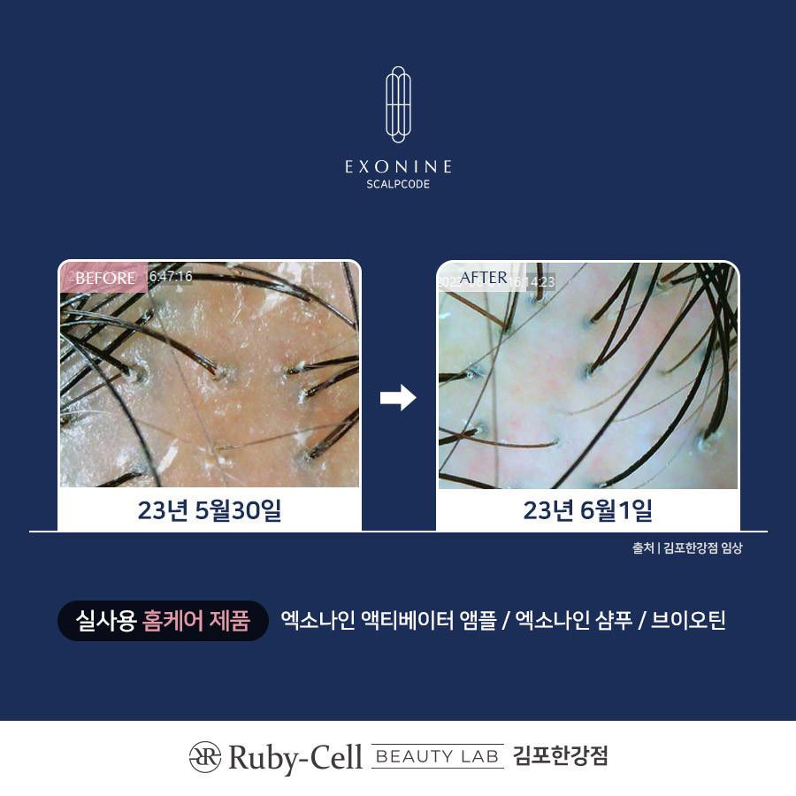 루비셀뷰티랩김포한강점