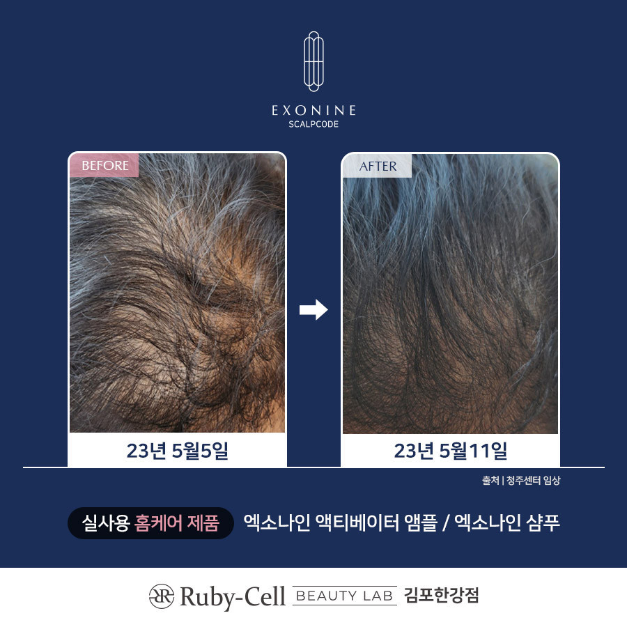 루비셀뷰티랩김포한강점