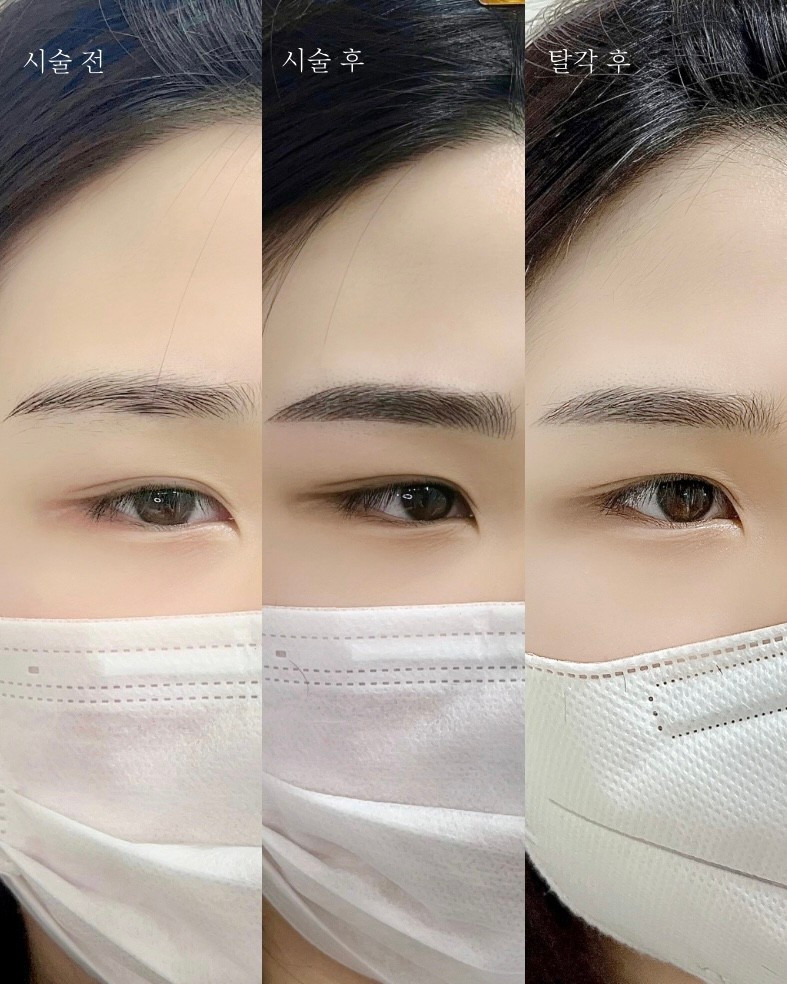 채우다눈썹