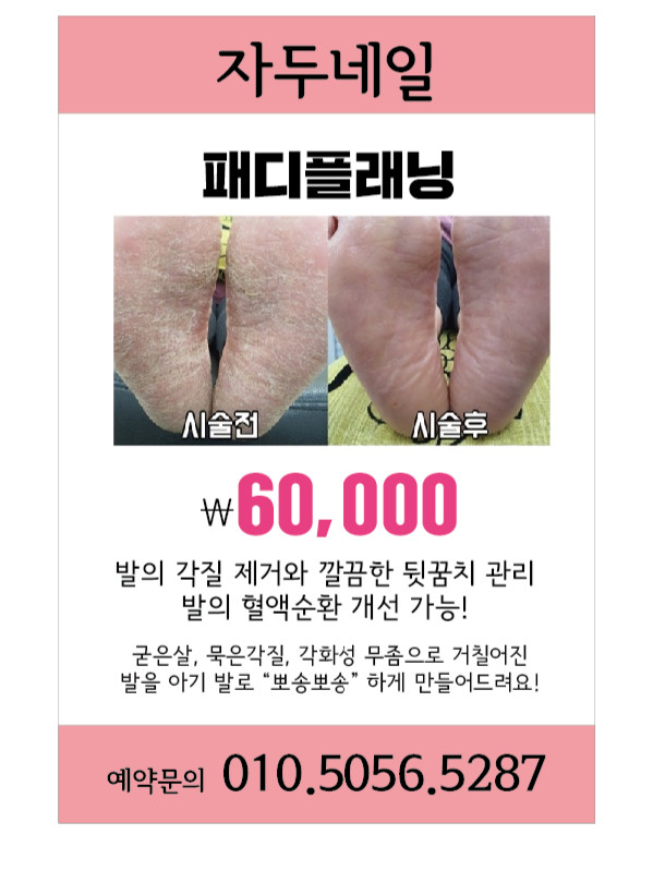 자두네일