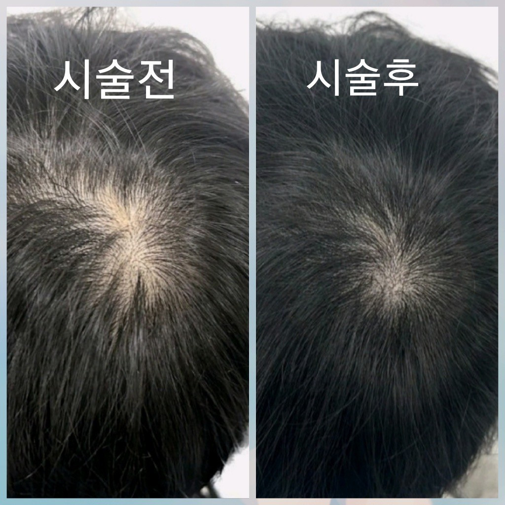 달빛뷰티