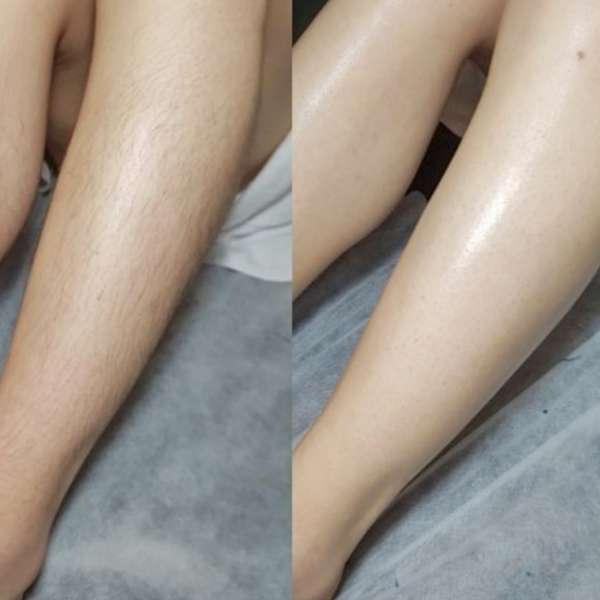 피부미인손발미인