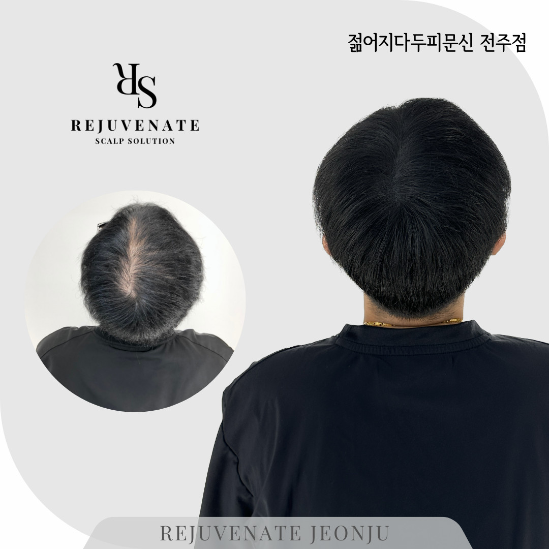 젊어지다